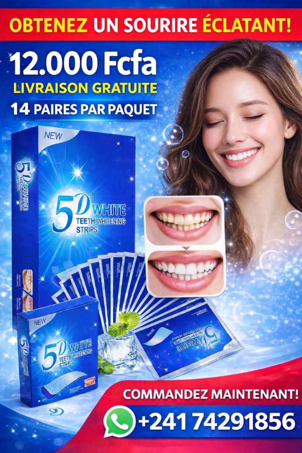 Blanchir ces dents avec nos Patches 5D White