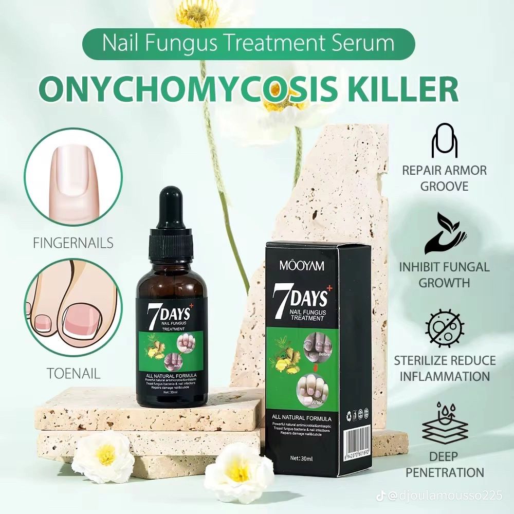 Comment retrouver des ongles nets et sains avec notre antifongique (même si vous souffrez depuis longtemps
