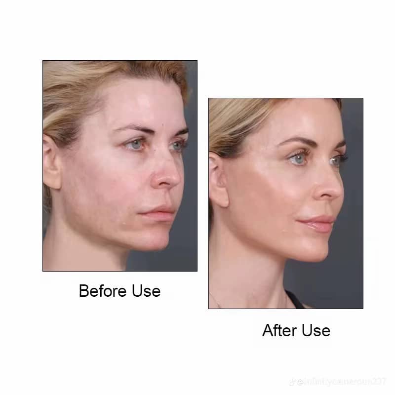 comment maigrir du visage facilement avec notre gaine amincissante