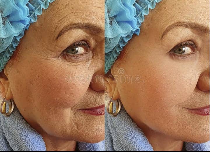 comment retrouver une peau saine et éclatante avec notre crème collagène?