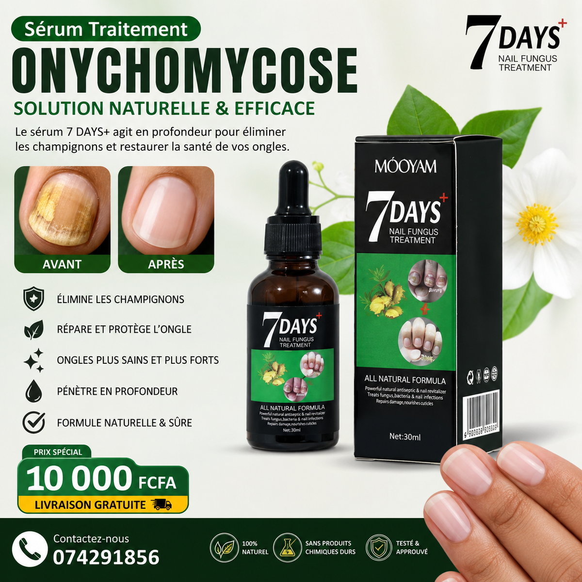 Comment retrouver des ongles nets et sains avec notre sérum antifongique 7 days